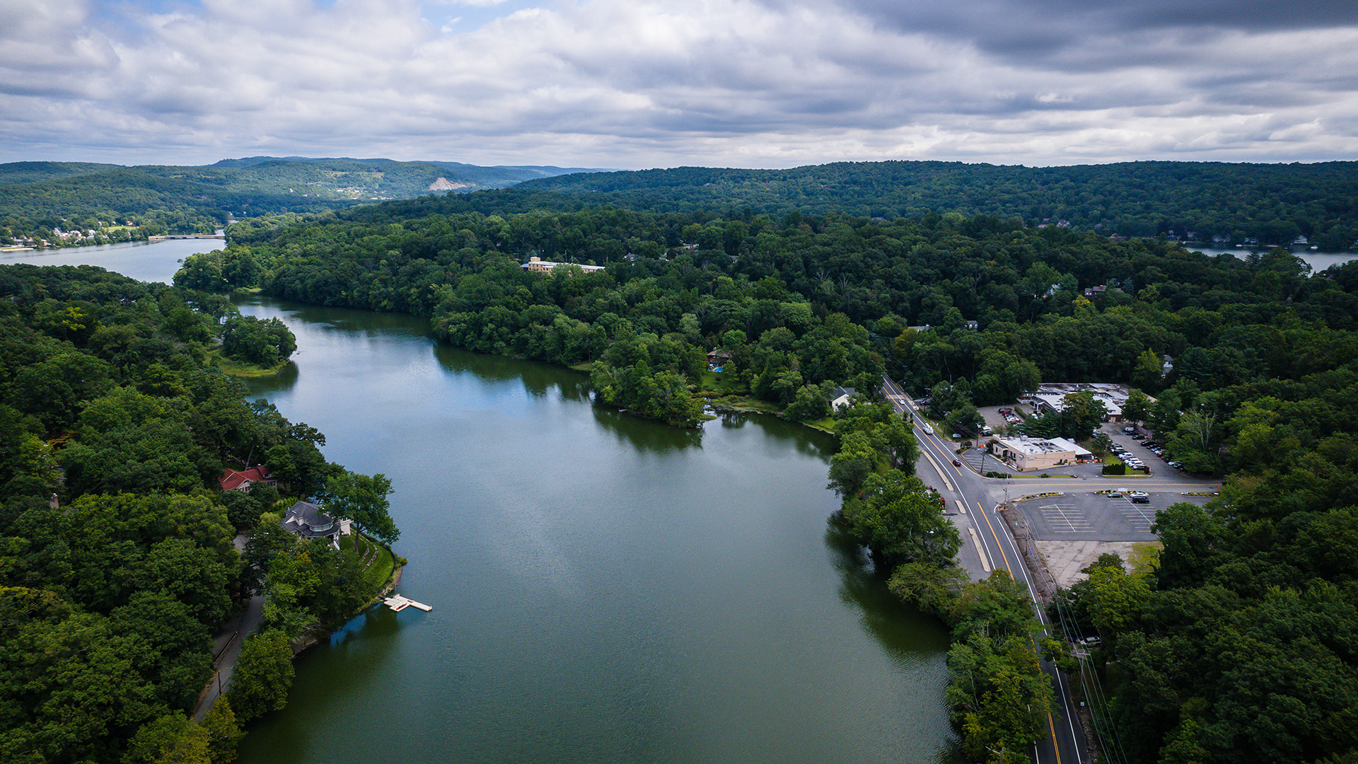 Schulman Dental Studio, Franklin Lakes | Extractions, Dentures and Dental Fillings