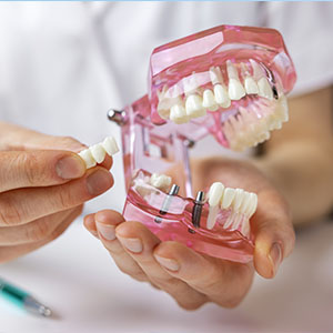 Schulman Dental Studio, Franklin Lakes | Dental Fillings, Crowns and Veneers