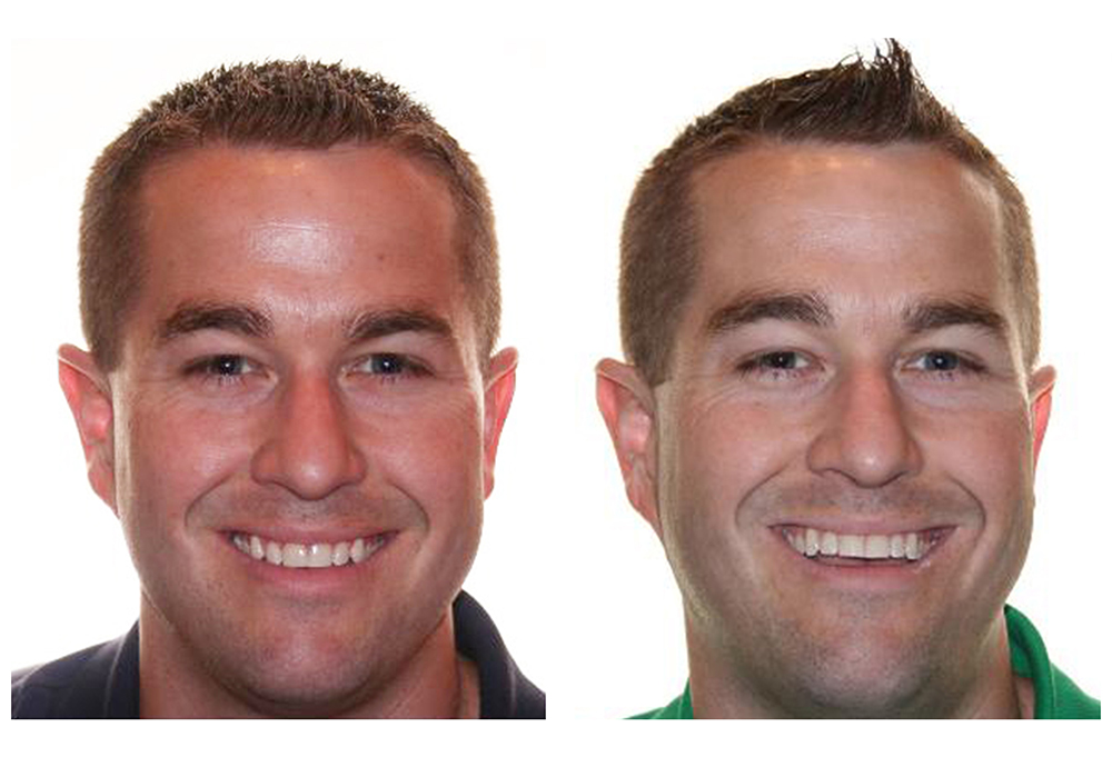 Denise Harburg-Johnson, DDS