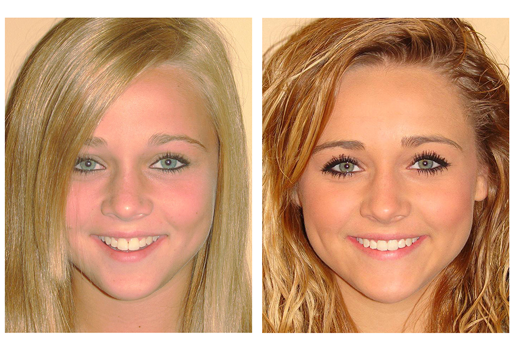 Denise Harburg-Johnson, DDS